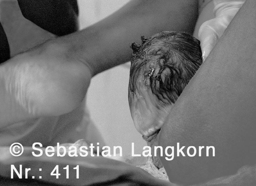 E0411GeburtSebastianLangkorn1987